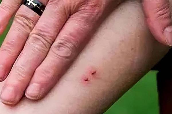 梦到被蛇咬是什么征兆 男性 梦到被蛇咬是什么征兆 男性