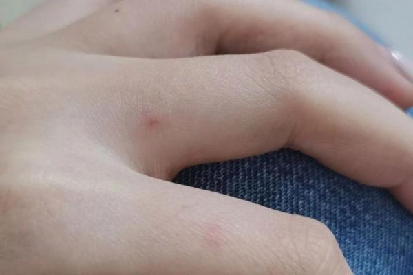 梦见被猫咬 梦见被猫咬