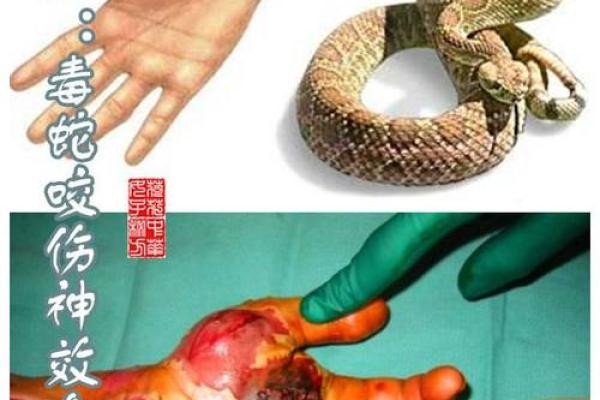 梦到被蛇咬是什么征兆 女性 梦到被蛇咬是什么征兆 女性
