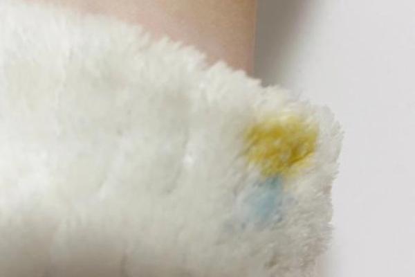 梦到被猫抓 梦到被猫抓