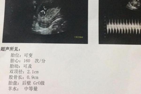 老公做梦梦到我生了个男孩 老公做梦梦到我生了个男孩