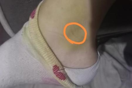 梦见猫抓我是什么预兆