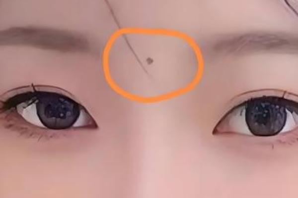 女人观音痣意味着什么 观音痣女人富贵一生 女人观音痣意味着什么 观音痣女人富贵一生