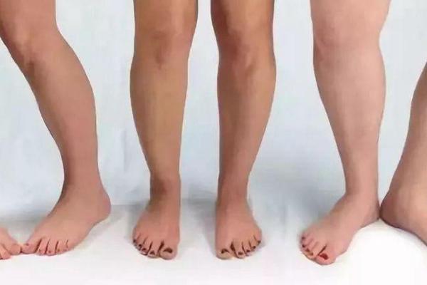 八字腿图片 八字腿图片