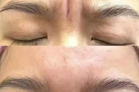 川字纹几种类型，一定要了解清楚：悬针纹、八字纹、双雀纹