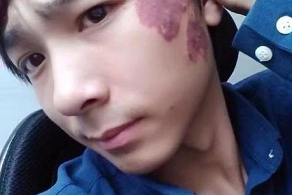 古算命，比较有福气的10处胎记