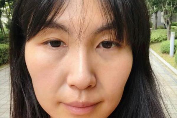 面部衰老八字图 面部衰老八字图