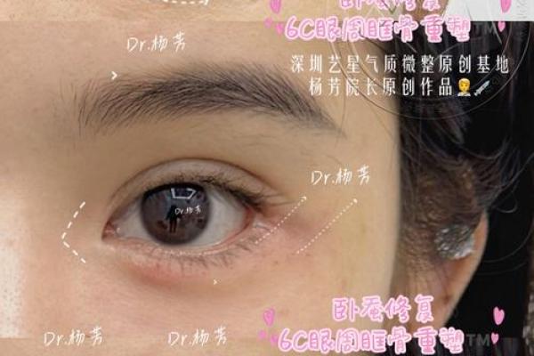 卧蚕眉面相算命图解