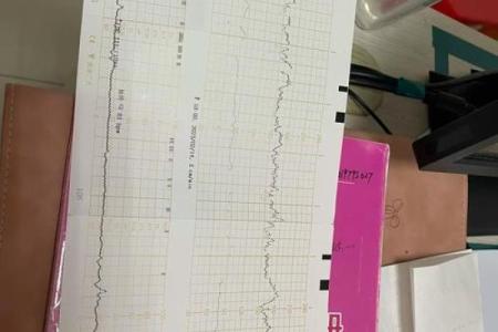 算命说打过胎实际没有胎心