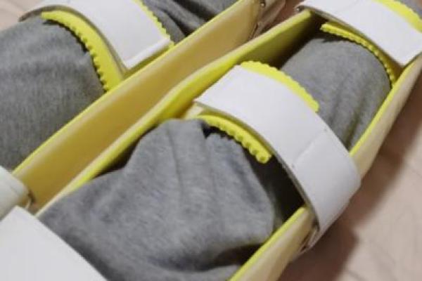 如何矫正外八字 如何矫正外八字