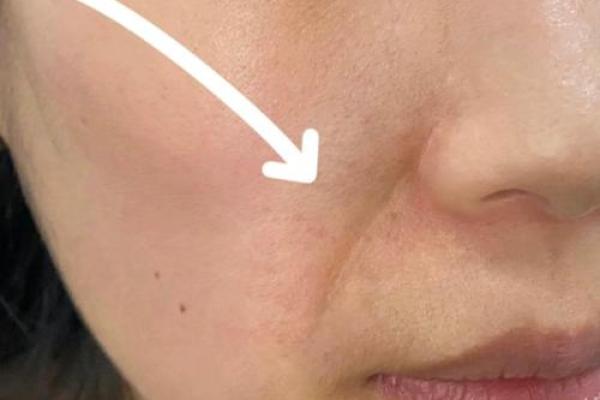 女八字纹 女八字纹