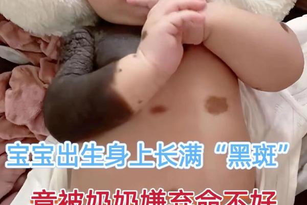 童子命的胎记及生辰八字如何查童子命