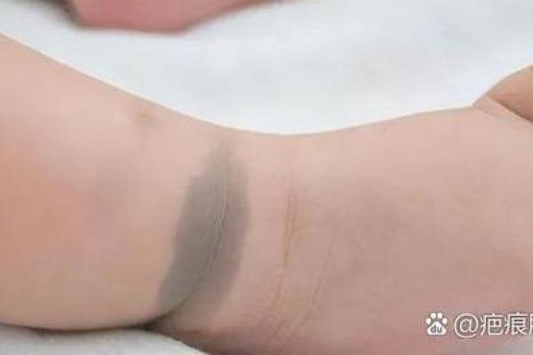 胎记算命:最好胎记长什么部位 胎记算命:最好胎记长什么部位