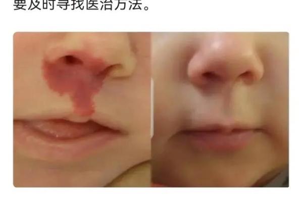 胎记算命:最好胎记长什么部位 胎记算命:最好胎记长什么部位