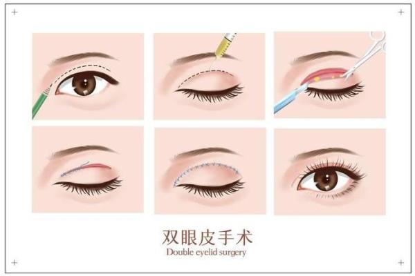 割双眼皮忌讳什么风水