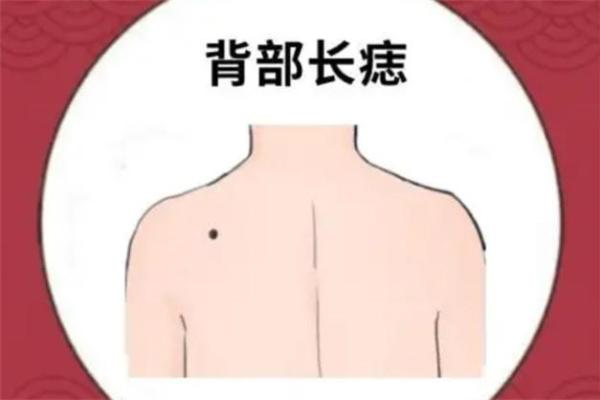 背上的痣图解算命