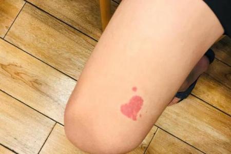 胳膊胎记可以算命吗-