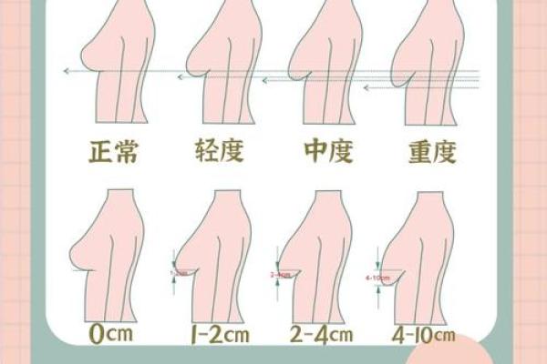 八字下垂奶 八字下垂奶