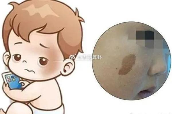 身体上的胎记位置不同算命分析 身体上的胎记位置不同算命分析