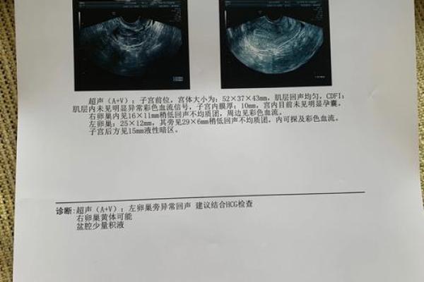 算命的算出宫外孕