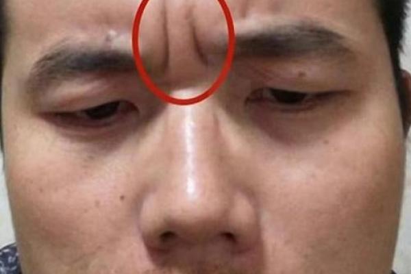 印堂八字纹的男人爱老婆吗