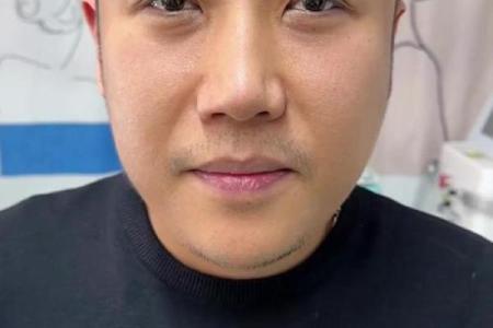 印堂八字纹的男人财运好吗