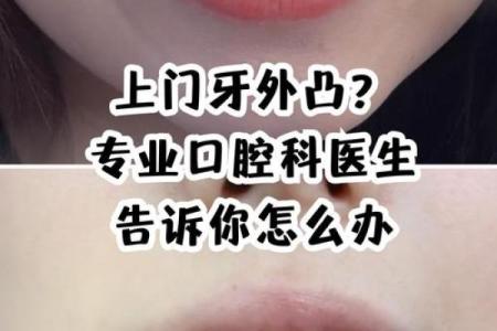 门牙外斜风水