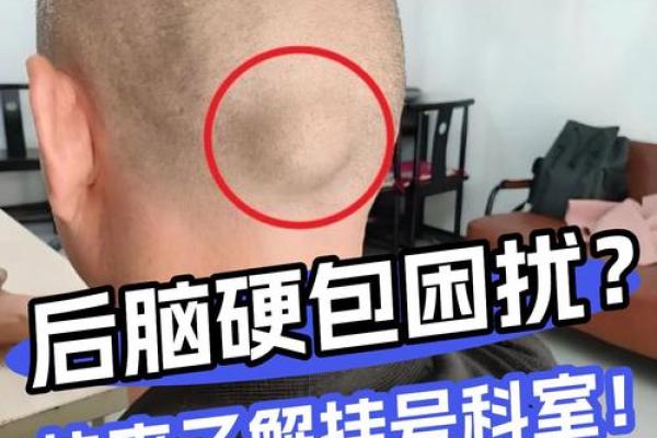 后脑勺有三条竖杠 后脑勺头皮三条竖纹算命