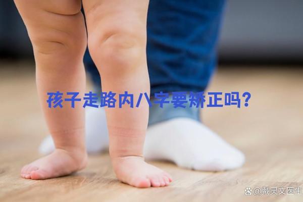 小孩走路内八字 小孩走路内八字