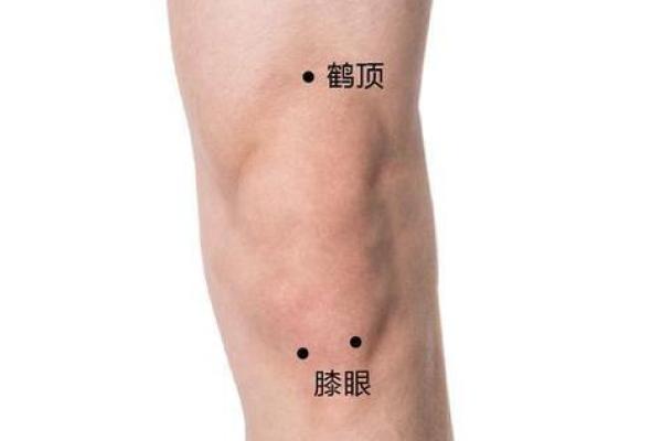 大腿上胎记的位置与算命 大腿上胎记的位置与算命