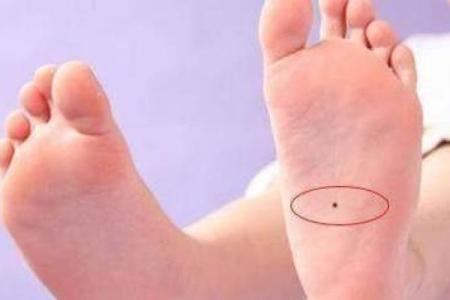 脚底的胎记算命分析