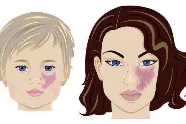 据脖子上胎记算命，有什么说法