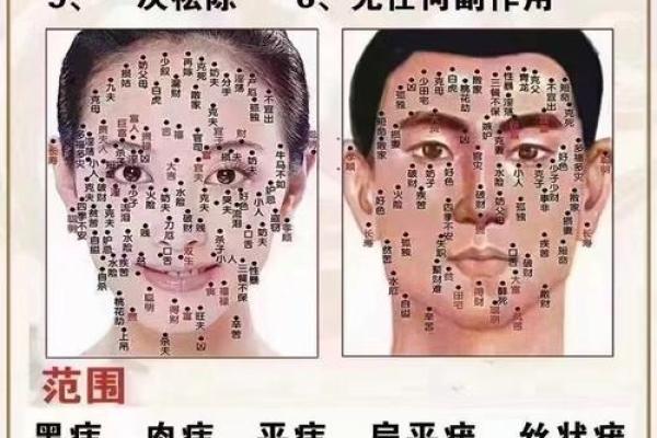 脸的各部位胎记算命详解 脸的各部位胎记算命详解