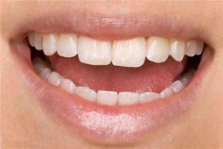 牙齿算命：牙齿的颜色看你的运势