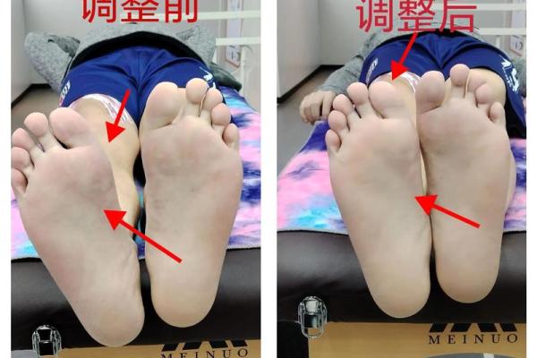 内八字和外八字 内八字和外八字