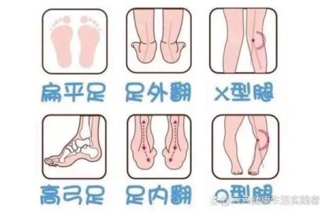 内八字和外八字